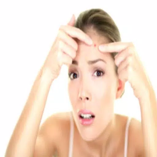 Get Rid of Acne  (Guide) Captura de pantalla 1